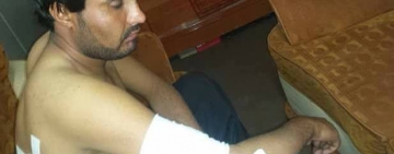 Journalist critically wounded after brutally stabbed in Kalat city